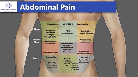 Typically, pain is felt in the lower right abdominal area. Appendicitis: A relatively common problem that can be seen in people between the ages of 11 and 40. Here abdominal pain is often sharp in .... 