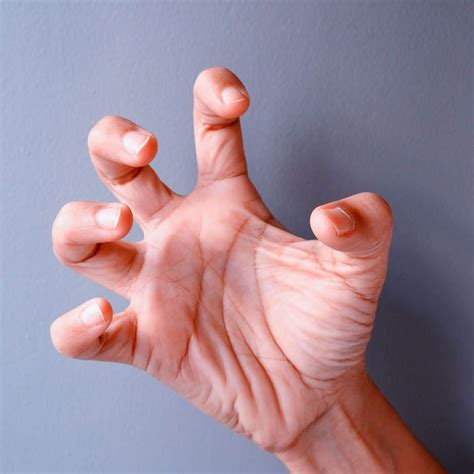 Dec 21, 2023 · Causes and treatments for twitching fingers. A twitch is a small, involuntary contraction and relaxation of a muscle or group of muscles. Medication side effects, physical exertion, fatigue, and ... . 