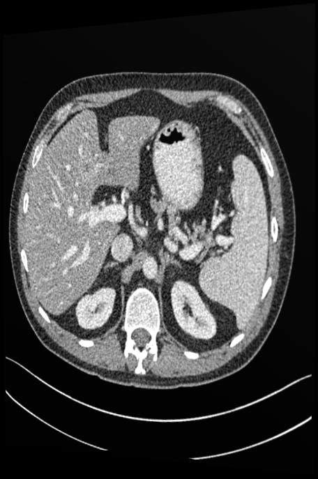 Two types of long-range dependencies in 3D CT images. (a) Intra …