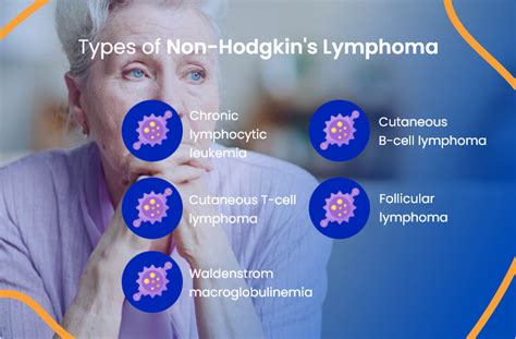 Types Of Lymphoma: What You Need To Know - Lymphoma News …