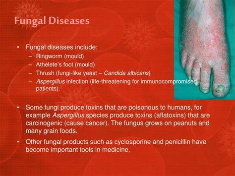 Types of Fungal Diseases Fungal Diseases CDC - Centers for Disease …