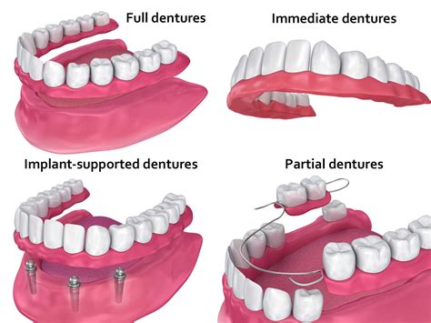 Types of Partial Dentures to Consider - Healthy Image Dental Group