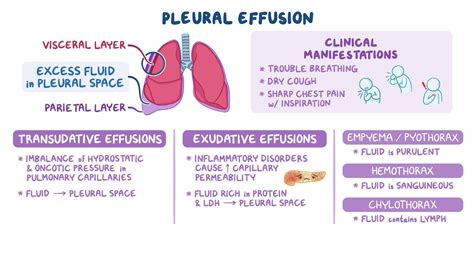 Types of Pleural Effusions SpringerLink