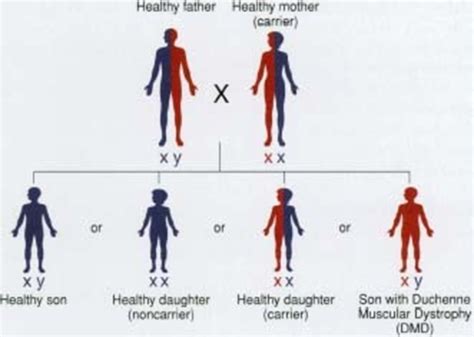 Types of muscular dystrophy Flashcards Quizlet