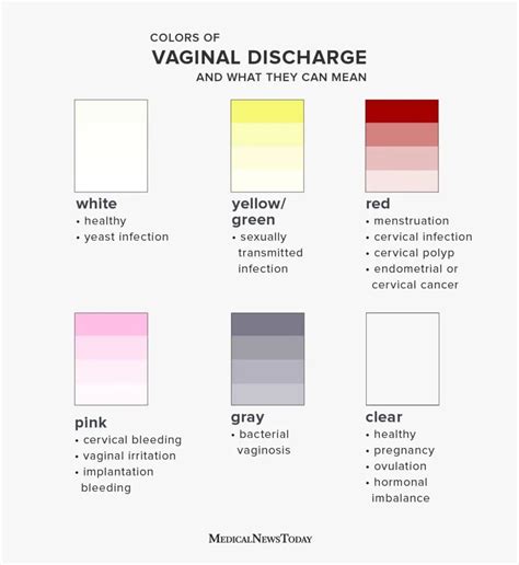 Types of white discharge and reason.  It is totally normal and keeps the vagin...