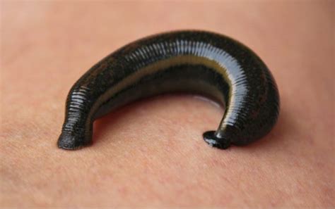 Ultimate Guide on How To Deal With Leeches During … - balustradellc