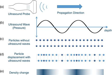 Ultrasound Waves - Medical Imaging Physics - Wiley Online Library - wintechmobiles.com