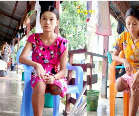 UN discusses on unattended privileges of disabled persons in Burma