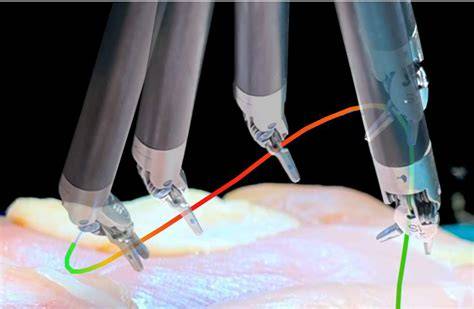 Underwater robotic suturing - PubMed - raincitystudios.com