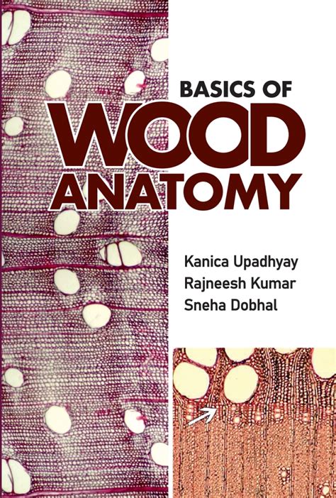 UPSC Notes on Wood Anatomy - Unacademy - raincitystudios.com