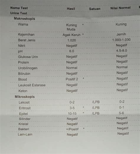 Urin Lengkap - wintechmobiles.com