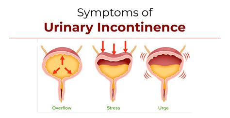 Urinary incontinence - Diagnosis - NHS - muktibox.com