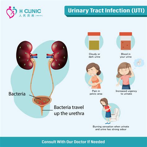 Urinary tract infection (UTI) - Symptoms and causes - Mayo Clinic - balustradellc