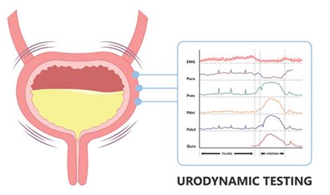 Urodynamics (Bladder Function Study) - Urology Associates of Central ... - muktibox.com