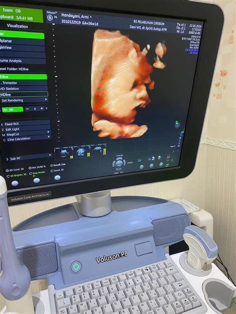 Usg Cirebon - wintechmobiles.com