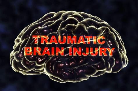 UT Austin researchers help develop blood test for traumatic brain injuries