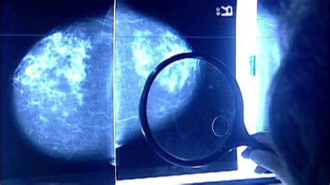 UVA researchers say new findings offer hope to keep breast cancer from spreading