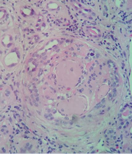 Uworld Incorrects - Biochem, Biostats and Social Sciences - wintechmobiles.com