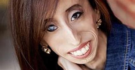 Ugliest person in the world. Sep 24, 2015 · The Mighty. September 24, 2015. Nine years ago, an anonymous person posted a video of Lizzie Velasquez at age 13 and titled it, “The World’s Ugliest Woman.”. It went viral. This is her ... 