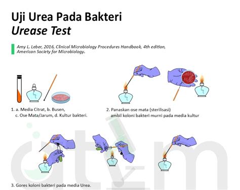 Uji Urea Pada Bakteri - Urease Test — Online Text Book ATLM