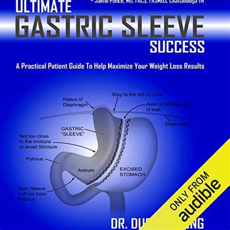 Ultimate gastric sleeve success a practical patient guide to help maximize your weight loss results. - Correspondance du nonce en france, angelo ranuzzi..