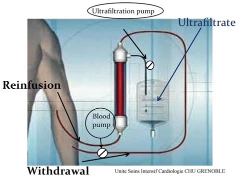 The installed ultrafiltration technology contains four units of ten modules, with a total maximum output of 100 m3h of . . Ultrafiltrate