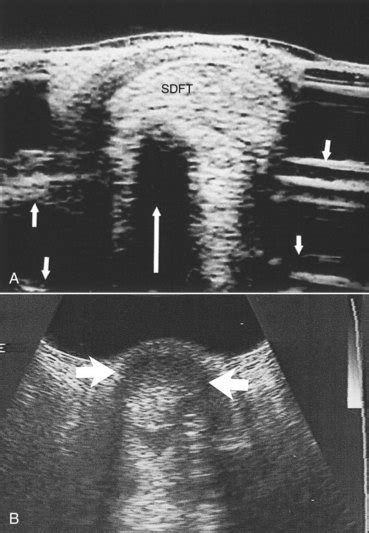 Ultrasonographic Evaluation of the Equine Limb: Technique Unbearable  awareness is