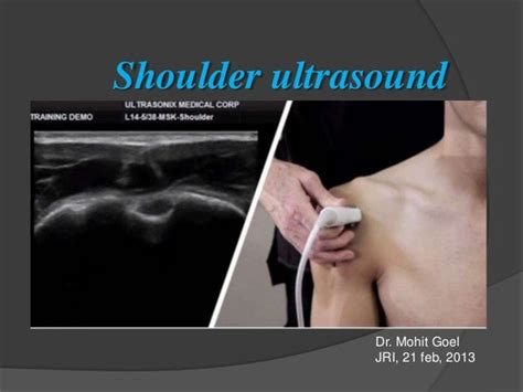 Ultrasonography of the shoulder - ScienceDirect