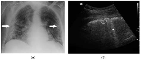 Ultrasound And X Ray Questions