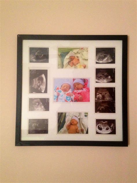 Ultrasound Collage Picture Frame