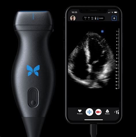 Ultrasound butterfly. For prescription use only. Butterfly iQ+/iQ3™ is a portable ultrasound system designed for external ultrasound imaging. Read the User Manual for warnings, precautions and/or contraindications. Not all presets, imaging modes and features are available everywhere. Check for availability in your country, subscription type, and software version. 