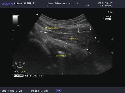 Ultrasound examination of the neck