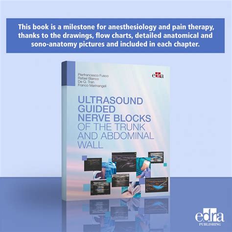 Ultrasound guided nerve blocks books free download. - Design guide for footfall induced vibration.