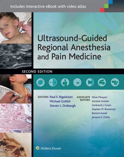 Ultrasound guided regional anesthesia and pain medicine. - New introduction to bibliography the classic manual of bibliography.