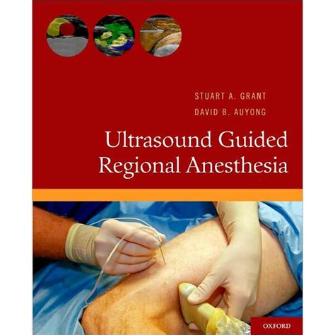Ultrasound guided regional anesthesia by stuart a grant. - Os autos do processo de vieira na inquisição.
