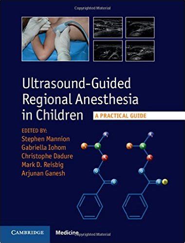 Ultrasound guided regional anesthesia in children a practical guide. - La vida en un frasco de preguntas del club de lectura.