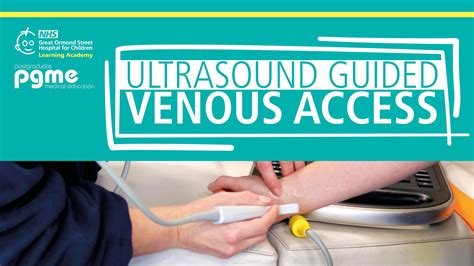 Ultrasound guided vascular access chapter 6 of emergency medicine. - Colleges and universities civil engineering professional new series of textbooks.