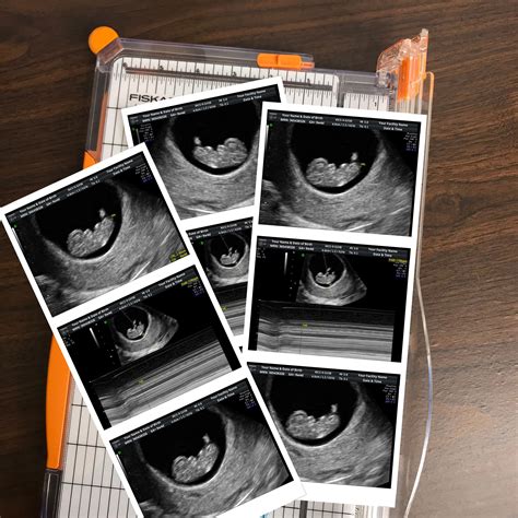 2D Fake Sonograms & 2D Fake Ultrasounds $5.99! 3D Fake Ultrasounds and 3D Fake Sonograms $14.99! New Ultra Fake Ultrasound Designs Fake Sonogram Videos Fake Pregnancy Documents Fake Pregnancy & Fake DNA Tests Fake Pregnancy Bellies. 
