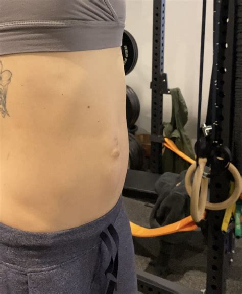Understanding Abdominal Coning What You Need To Know During Pregnancy