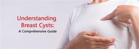 Understanding Breast Cysts Saint Luke