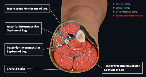 Understanding Compartment Syndrome: What is it and How to …