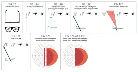 Understanding Prism Designs for Homonymous Hemianopsia