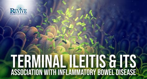 Understanding Terminal Ileitis and Its Link with IBD.