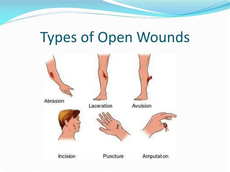 Understanding the 6 Major Types of Acute Open Wounds