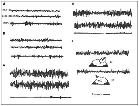 Unihemispheric sleep and asymmetrical sleep: behavioral ...