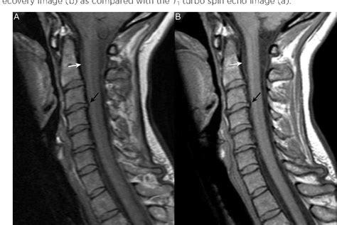 Uniontown Hospital MRI Cervical Spine Cost Comparison