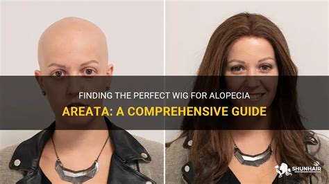 Unlock Confidence: The Ultimate Guide to Finding Your Perfect Alopecia Wig