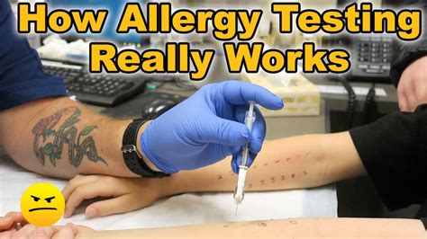 Unlocking the Secrets How Long Does Allergy Testing Really Take