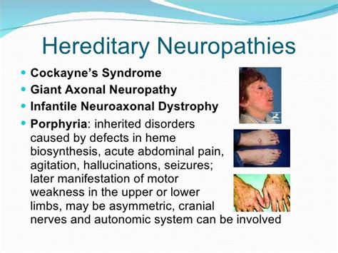 Unspecified hereditary and idiopathic peripheral neuropathy