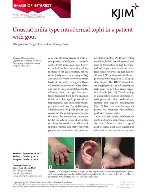 Unusual milia-type intradermal tophi in a patient with gout